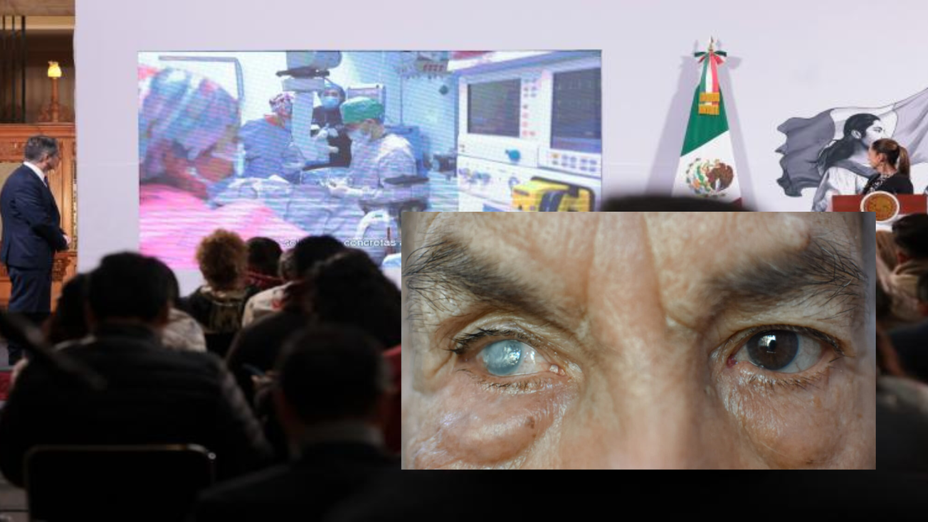Ver por México: cómo acceder a una operación de cataratas gratis